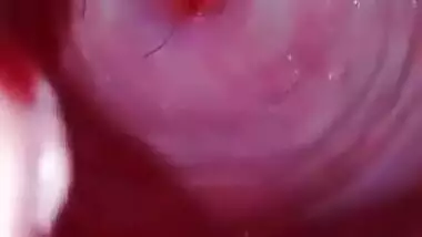 Ig pussy whle